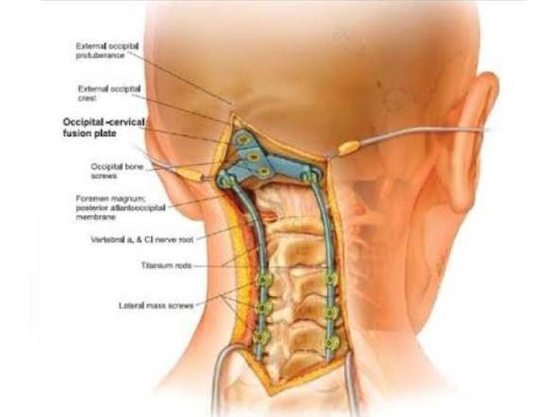 Best urology hospitals in Vijayawada,best urology doctors in Vijayawada,Best urology specialists in Vijayawada,best urology treatment hospitals in Vijayawada,Best paediatric urologists in Vijayawada,Best kidney Stone treatment in Vijayawada,Best prostate Gland treatment in Vijayawada,Best Laparoscopic Surgery in Vijayawada,Best Bladder Stone treatment in Vijayawada,Best Ureters Treatment in Vijayawada,Best Retrograde ureteral in Vijayawada,Best kidney transplantation in Vijayawada,Best prostatic hyperplasia Treatment in Vijayawada,Best Urologist in Vijayawada,Best Urinary Incontinence Treatment in Vijayawada,Best Gastroenterologists in Vijayawada,Best Gastroenterology hospitals in Vijayawada,Best Gastroenterology hospital in Vijayawada,Best gastroenterology treatment in Vijayawada,Best Gastroenteritis Treatment in Vijayawada,Best Hepatitis B Treatment in Vijayawada,Best Hernia Treatment in Vijayawada,Best Gallstones Treatment in Vijayawada,best neurosurgeon in Vijayawada,Best Brain tumor hospitals in Vijayawada,Best Stroke treatment in Vijayawada,Best Paralysis Treatment in Vijayawada,Best Rehabilitation Center in Vijayawada,Best Paediatric neurosurgery in Vijayawada,Best Neurovascular surgery in Vijayawada,Best Spine surgery in Vijayawada,Best Arthritis treatment in Vijayawada,Best Tumor removal in Vijayawada,Best Brain tumor treatment in Vijayawada,Best Neuro Surgery hospital in Vijayawada,Best neurology hospitals in Vijayawada,Best neurology doctors in Vijayawada,Best Neurologists in Vijayawada,best neurologist doctor in Vijayawada,Best Fits treatment in Vijayawada,Best Stroke Center in Vijayawada,Best Paralysis treatment in Vijayawada,Best Coma treatment center in Vijayawada,Best Migraine Hospital in Vijayawada,Best Spinal Card Injury Treatment in Vijayawada,best laparoscopic surgeon in Vijayawada,Best gall bladder stone removal surgery cost in Vijayawada,best general surgeon in Vijayawada,best gallbladder laparoscopic surgeon in Vijayawada,Best Advanced Laparoscopic and General Surgery in Vijayawada,Best Laparoscopic General Surgery in Vijayawada,best surgeon in Vijayawada,Top Laparoscopic surgeon Vijayawada,Best laparoscopic surgery hospitals in Vijayawada,Best Appendix Treatment in Vijayawada,Best Laparoscopic surgery in Vijayawada,Best Gallbladder microscope surgeons in Vijayawada,Advanced laparoscopic and general surgery hospitals in Vijayawada,Best General Surgery Hospitals in Vijayawada,best General Medicine Doctors in Vijayawada,Best General Physician Doctors in Vijayawada,Best General physicians in Vijayawada,Best General Medicine for Hypertension,Best Diabetologist in Vijayawada,Best Diabetics Hospital in Vijayawada,Best fever Hospital in Vijayawada,Best infections treatment in Vijayawada,Best Hypertension treatment in Vijayawada,Best thyroid treatment in Vijayawada,Best Hospitals for Pulmonology in Vijayawada,Best Pulmonologists in Vijayawada,Top Pulmonologists Doctors in Vijayawada,Best Pulmonology hospitals in Vijayawada,Best Asthma treatment in Vijayawada,Best Lung cancer treatment in Vijayawada,Best breathe easy treatment in Vijayawada,Best Asthma Specialist in Vijayawada,Best gynaecology hospitals in Vijayawada,Best gynaecology specialists in Vijayawada,best gynaecology hospitals in Vijayawada,Best obstetrics and gynaecology hospitals in Vijayawada,Best obstetrics and gynaecology doctors in Vijayawada,Best Uterine Bleeding treatments in Vijayawada,Best Painless Delivery Hospital in Vijayawada,Best High risk Pregnancy hospital in Vijayawada,best Orthopaedician in Vijayawada,best orthopaedic doctor in Vijayawada,Total Knee Replacement in Vijayawada,Best Knee Replacement surgery in Vijayawada,best Knee Replacement surgeon in Vijayawada,Hip Replacement in Vijayawada,Best joint replacement in Vijayawada,best Hip Replacement surgeon in Vijayawada,Best Fracture treatment in Vijayawada,Best injury treatments in Vijayawada,Best Arthritis treatment in Vijayawada,Best paediatrics specialists in Guntur,Best paediatrics physicians in Guntur,Best children’s paediatrics in Guntur,Best paediatrics and child health care hospitals in Guntur,Best general paediatrician in Guntur,best children’s hospitals in Guntur,Best Chest Specialists in Vijayawada,Best Chest physicians in Vijayawada,Best Chest Physician Hospitals in Vijayawada,Best pulmonologist doctors in Vijayawada,best lungs specialist in Vijayawada,Best lungs hospital in Vijayawada,Best asthma specialist in Vijayawada,Best ENT clinics in Vijayawada,best ent specialists in Vijayawada,best ENT doctors in Vijayawada,best ENT hospitals in Vijayawada,MICRO EAR SURGERIES in Vijayawada,Best SINUSITIS Treatments in Vijayawada,Best TONSILLITIS Treatments in Vijayawada,Best Hearing Loss Treatment in Vijayawada,Best Sore Throat Treatment in Vijayawada,Best Anaesthesiology Doctors in Vijayawada,Best Anaesthesiology Services for Surgery in Vijayawada,Best Anaesthesiology Critical Care in Vijayawada,Best Pain Management Doctors in Vijayawada,Best intensive care specialist in Vijayawada,best Accident & Emergency Hospitals in Vijayawada,Best Emergency Services Providers in Vijayawada,Best Emergency care in Vijayawada,Best Accident Injuries Treatment in Vijayawada,Best Skin Specialists in Vijayawada,Best Skin Care Clinics in Vijayawada,Best Dermatologist Doctors in Vijayawada,Best Radiologists in Vijayawada,Best Radiology Clinics in Vijayawada,Best radiology doctors in Vijayawada,Best female radiologist in Vijayawada,Best Dental Hospitals in Vijayawada,Best Dental Doctors in Vijayawada,Best Clip Treatment in Vijayawada,Best Orthodontist in Vijayawada,Best braces treatment in Vijayawada,Best Root Canal Treatment in Vijayawada,Best Dental Implant Center in Vijayawada,Best Dentist in Vijayawada,Best Gum diseases treatment in Vijayawada